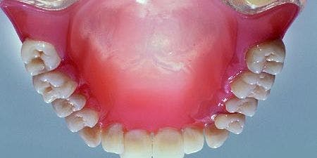 Die Zahnschiene mit Biofeedback gegen Zhneknirschen in Langenargen | wlw.de Die Zahnschiene mit Biofeedback gegen Zhneknirschen in Langenargen | wlw.de