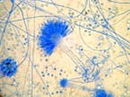 Schimmelpilz Aspergillus 